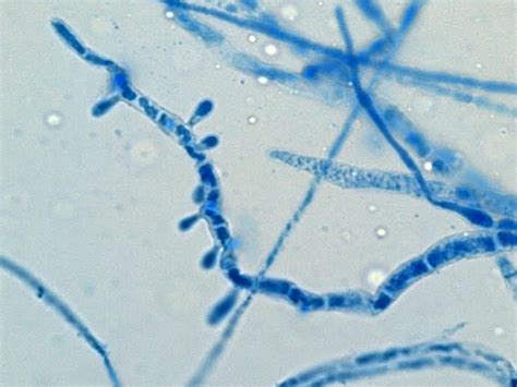 Fun With Microbiology (What's Buggin' You?): Trichophyton rubrum