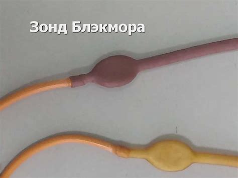 Кровотечения и кровопотеря. Принципы диагностики и лечения. Методы ...