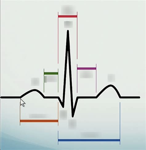 Label the Basic ECG Waves and Intervals Diagram | Quizlet