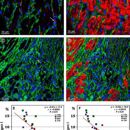 Telocytes Tcs Are Decreased In Areas Of Collagen Accumulations