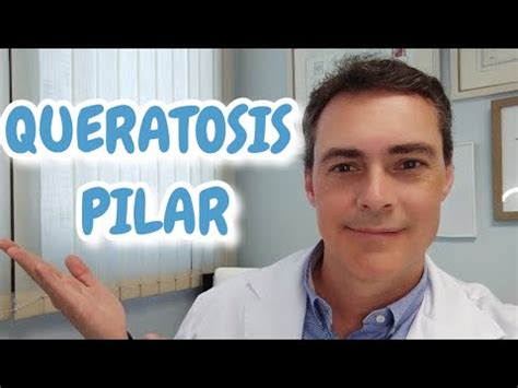 Dermatólogo explica qué es la queratosis pilar o hiperqueratosis