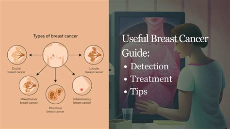 Useful Breast Cancer Guide Detection Treatment And Procedures