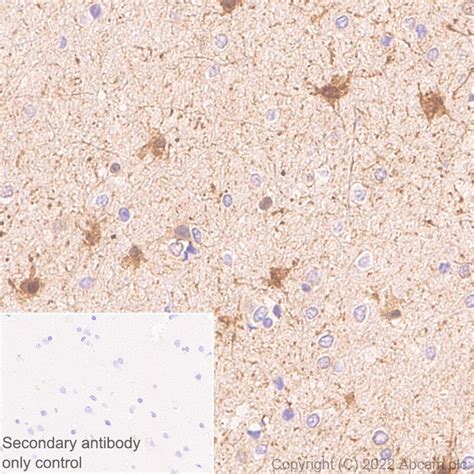 Anti Aldolase C C Terminal Epr Ab