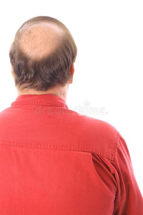 Mans bald head. Isolated on white , #Aff, #bald, #Mans, #head, #white ...