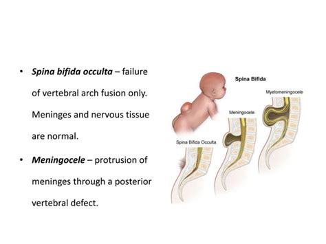 Spinal Anaesthesia - Anatomy & Physiology | PPT