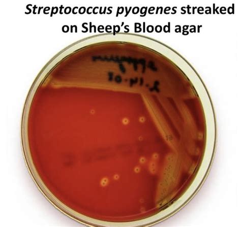 Microbiology Lab Final Exam Study Guide Flashcards Quizlet