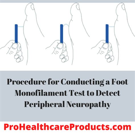 Diabetic Neuropathy Monofilament Foot Screen - prohealthcareproducts.com
