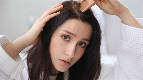 Lets Talk Dandruff Why You Get It How You Can Treat It And Everything In Between