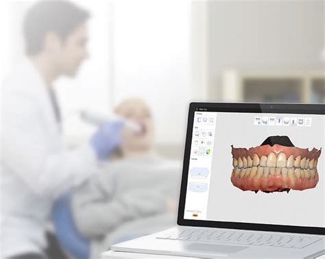 Escáner Intraoral Clinica Maxi Dental