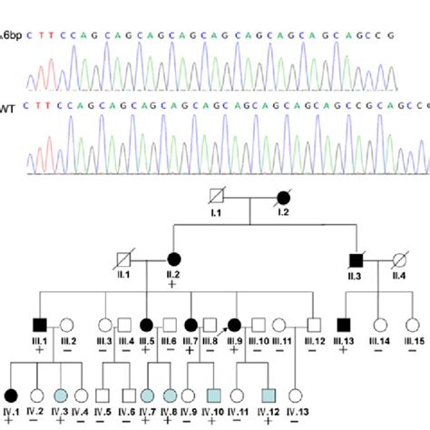 A Dna Sequence Analysis Of The Wild‑type Wt Allele And The 6‑base