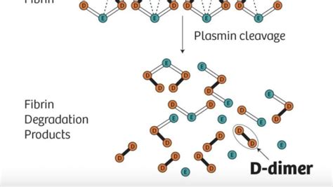 D Dimer And Fibrinogen By Aaron Goodman Papa Heme