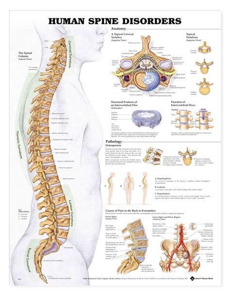 Human Spine Disorders Anatomical Chart Algeos