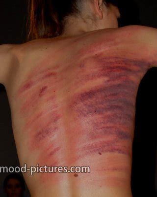 Extreme Lesbian BDSM 4 Porn Pictures XXX Photos Sex Images 1663645 PICTOA