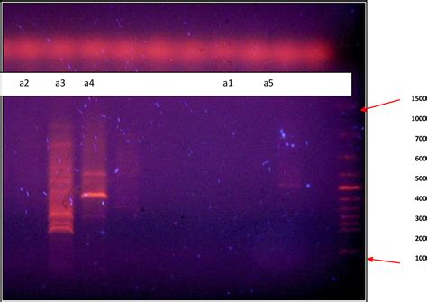 Figure 1 From Detection Similarity And Differences Between Uropathogenic Escherichia Coli