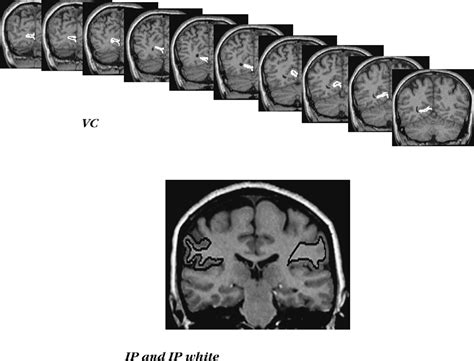 Structure of entorhinal cortex | Semantic Scholar