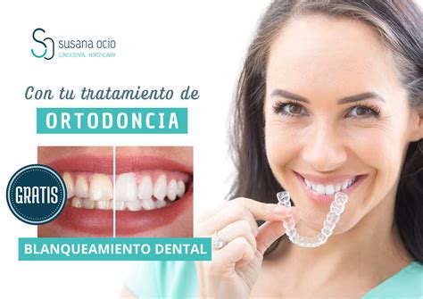 Ortodoncia Blanqueamiento Dental Gratis