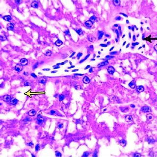 Photomicrograph Of Liver Showing Thin Capsule Glisson S Capsule