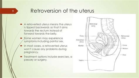 Antenatal Obstetric Complication