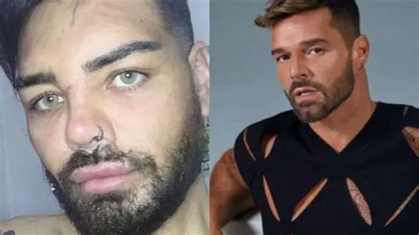 Ator Argentino Faz Mais De 30 Cirurgias Para Se Parecer Ricky Martin