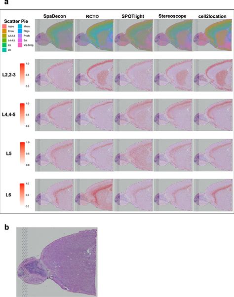 Cell Type Deconvolution Results For X Visium Mouse Brain Serial