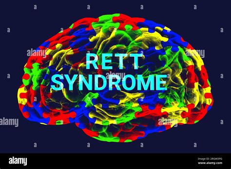 Rett syndrome, conceptual illustration Stock Photo - Alamy