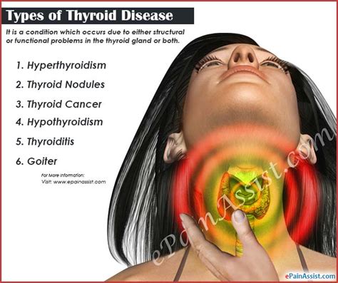 Thyroid Disease Types Causes Symptoms Treatment Prognosis Epidemiology Prevention