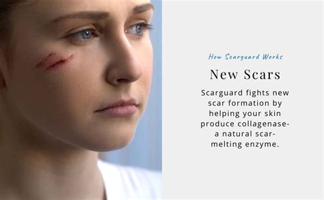 Scarguard Scar Treatment - Use For New & Old Scars - With Silicone ...