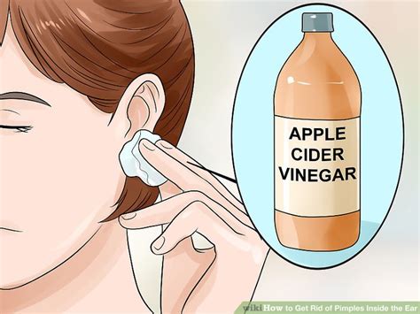 3 Ways To Get Rid Of Pimples Inside The Ear Wikihow