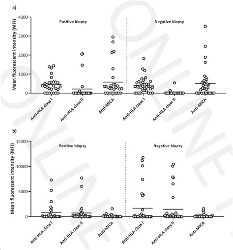 Determination Of The Level Of Anti Hla Class I And Ii Antibodies And