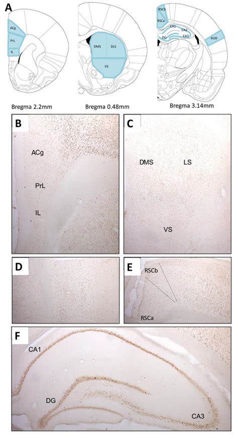 Figure From Identification Of The Neural Correlates Underlying