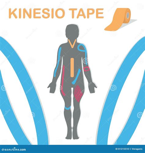 Kinesiology Tape Treatment Royalty-Free Stock Photo | CartoonDealer.com ...