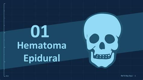 Hematoma Epidural Resumenesmedicos100 UDocz