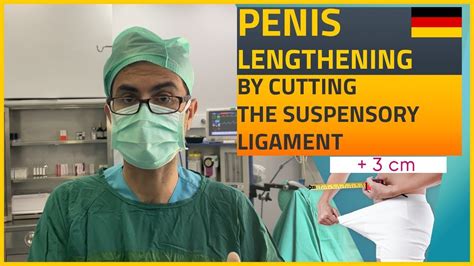 Penis Lengthening By Cutting The Suspensory Ligament Youtube