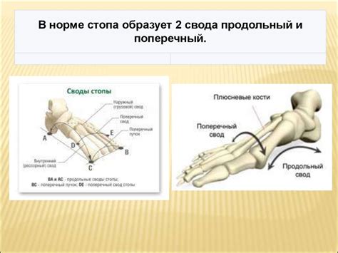 Плоскостопие. Виды плоскостопия - презентация онлайн
