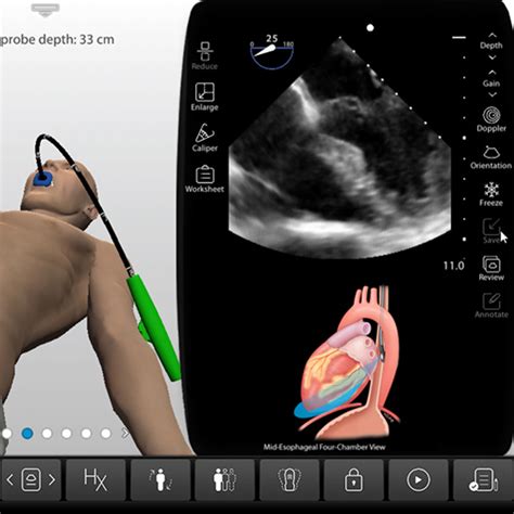 Transesophageal Echocardiogram TEE - Resuscitative TEE Ultrasound Training