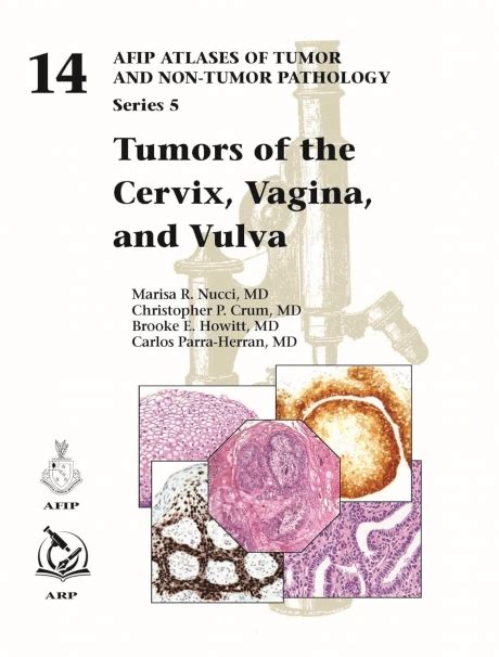 IΑΤΡΙΚΗ Tumors of the Cervix Vagina and Vulva
