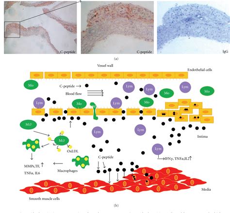 Figure From Proinflammatory Effects Of C Peptide In Different Tissues