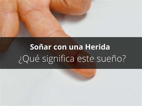 Soñar con una Herida Qué significa este sueño Wikilibre