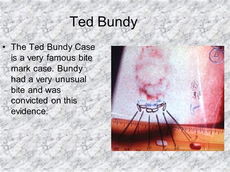 Okay So Ted Bundy S Bite Mark Tattoo Is The New Hot Thing Now Didn