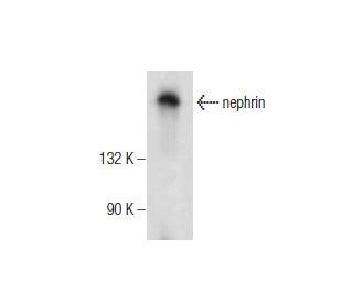 nephrin Antibody (G-8) | SCBT - Santa Cruz Biotechnology