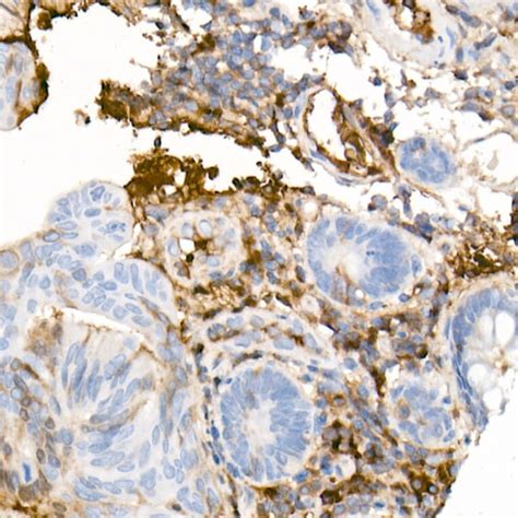 anti human igg antibody arc  antibodiescom