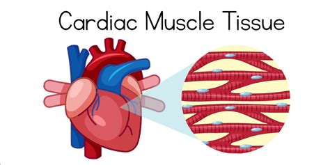 Cardiomyopathy: Symptoms, Causes, and Diagnosis - heartathon.com