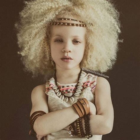 Meet Ava Clark The Beautiful And Little Albino Black Girl Albino