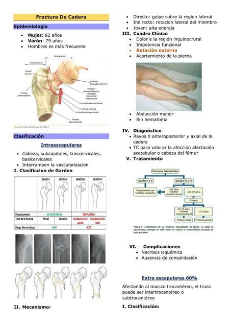 Fractura De Cadera Alvaro Jesus Romero Rodriguez Udocz