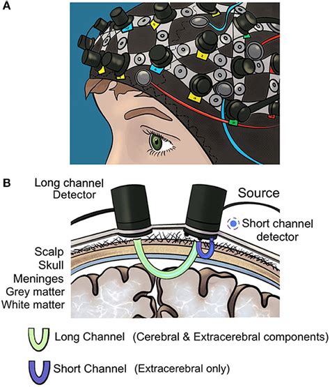 Frontiers Optical Neuroimaging And Neurostimulation In Surgical