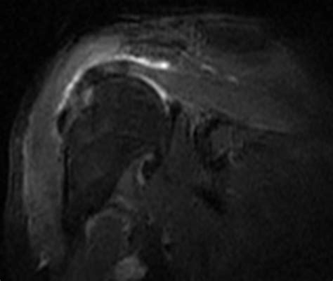 Medview Medical Imaging Consultancy Info Page Motion Artifact On Mri