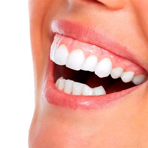 Sonrisa gingival cuál es el tratamiento idóneo para corregirla