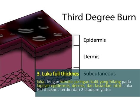 Modul 3 Kb 2 Proses Penyembuhan Luka