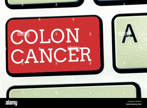 Signo De Texto Mostrando El Cáncer De Colon Foto Conceptual Cáncer Que