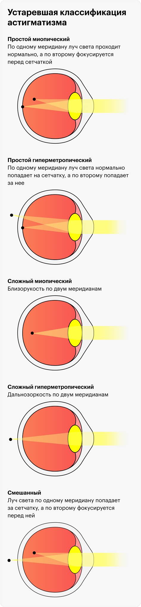 Астигматизм и дальнозоркость у детей